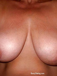 Busty Breast Reductions - Set 25