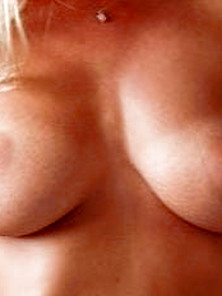 My Breasts