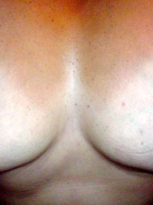 My Tits