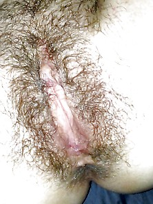 Close Up Hairy Pussy