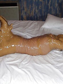 Gauze Mummification