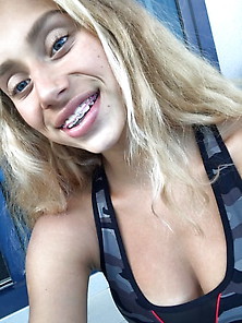 Blonde Teen Braces