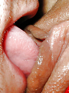 Oral